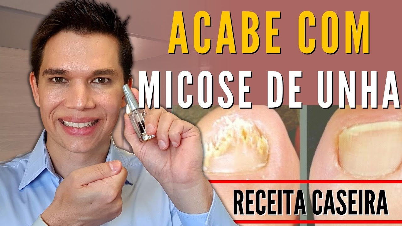 micose de unha